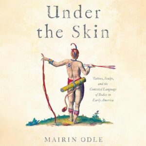 Under the Skin